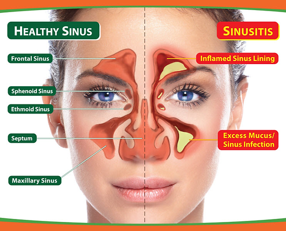 Smart Ways to Straighten Teeth: 7 Effective Options for a Bright Smile in 2025